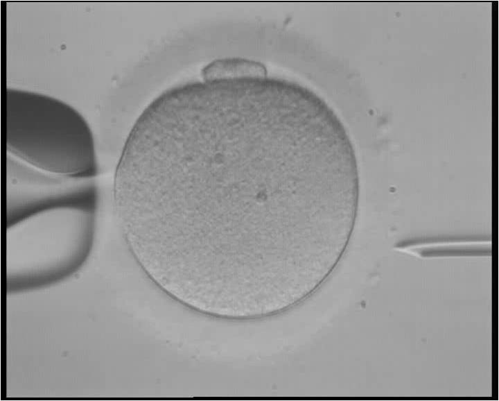 Resultado de imagen para fertilización in vitro